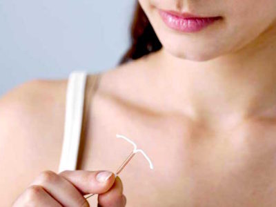 Vòng tránh thai là dụng cụ có hình dạng chữ T, được sản xuất theo một quy trình khép kín.